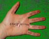 ergotherapie christine pohn yehiely