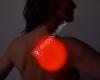 Lasertherapie Polly: Wundlaser, Schmerzlaser, Blutlaser, LLLT bei Mukositis