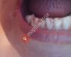 Zahnarzt Prim. Dr. Siegmund Doettelmayer, MDSc, dentale Zirkon-Implantate, CMD